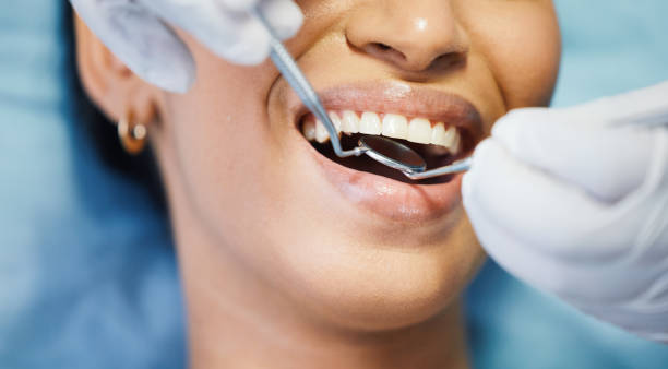 Best Emergency Wisdom Teeth Removal in Viera West, FL